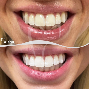 Slider image (4) A-dent Dental Clinic